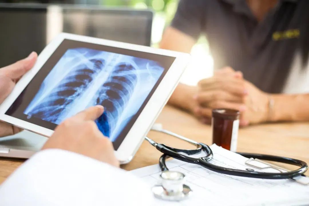 为什么很多肺癌发现已是晚期?这5种症状都在提醒你,却被忽视!
